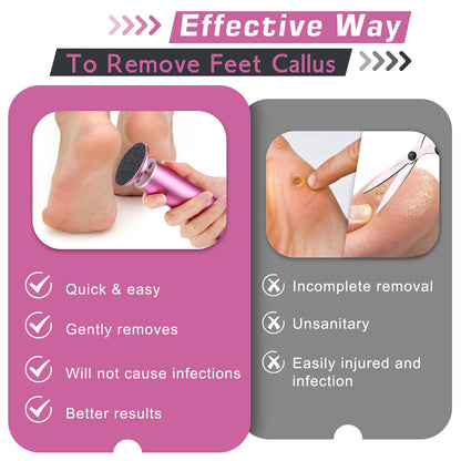 LifesLittleStepsCo Electric Foot Callus Remover